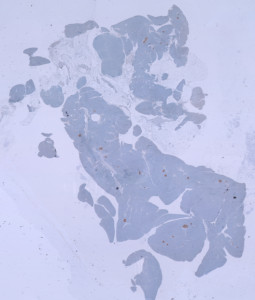 Corte de pancreas de ratón con DM2.